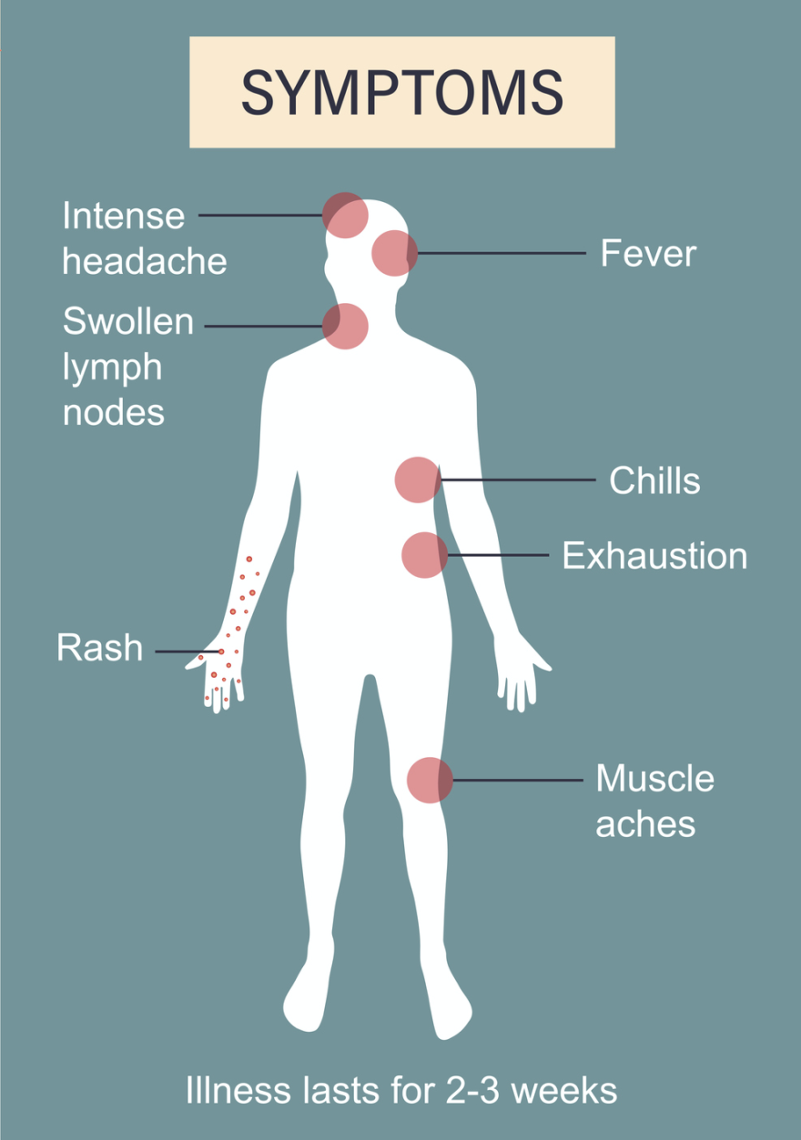 Illustration of monkeypox symptoms