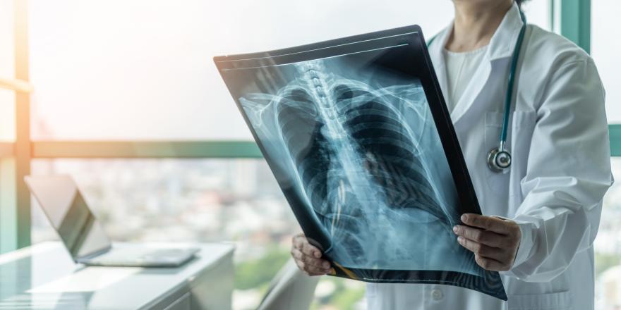 Doctor looking at X-Ray of lungs